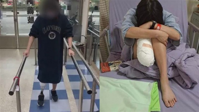 台灣一女包裝工遭遇工業意外須截肢，工廠被判罰款停工。網上圖片