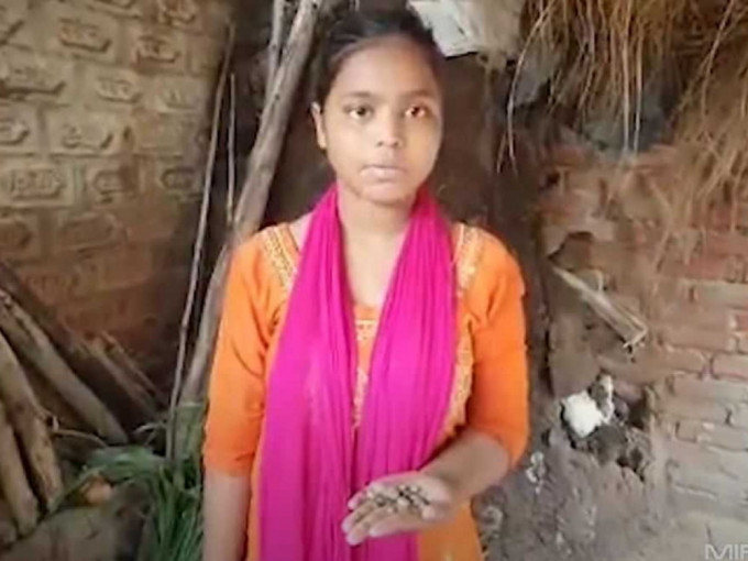 印度15岁少女流「石头泪」病因成谜。网图