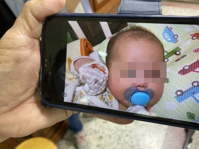 台灣當局解剖檢驗指，母親打針後餵母乳猝死的女嬰，有呼吸道感染。網圖