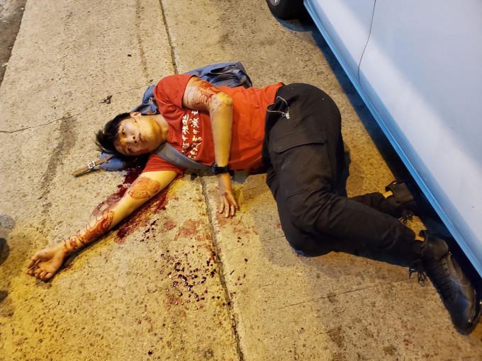 民間人權陣綫召集人岑子杰周三旳上遇襲受傷。（資料圖片）