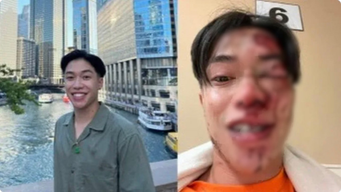 美國亞裔大學生布蘭登（Brandon）在洛杉磯音樂節場館外遭圍毆。 GoFundMe