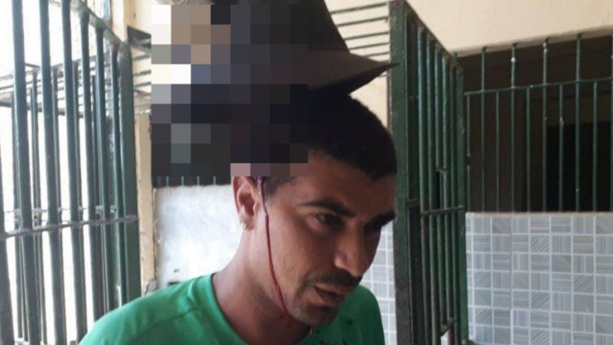 巴西一名囚犯头插弯刀求医，若无其事与人交谈。网上图片
