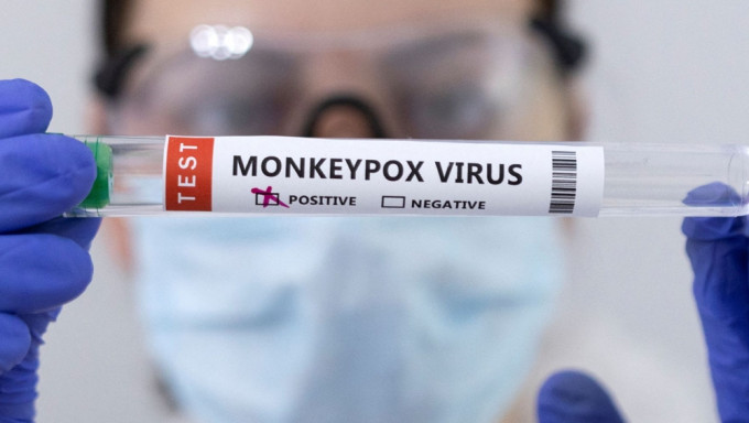 据报美国已有近千宗猴痘确诊。路透社图片