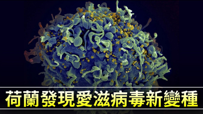 VB病毒在電子顯微鏡下的影像。美聯社圖片