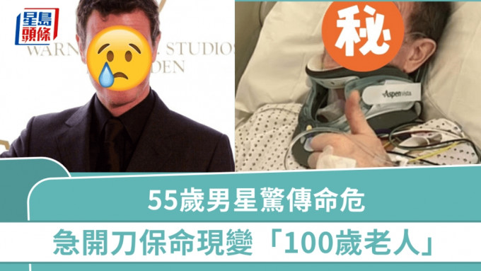 55歲男星驚傳命危  醫生警告或終身殘廢變啞巴  冒大險急開刀現變「100歲老人」