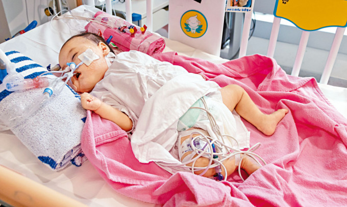 罹患「扩张性心肌病」的女婴芷希，成功完成心脏移植手术。