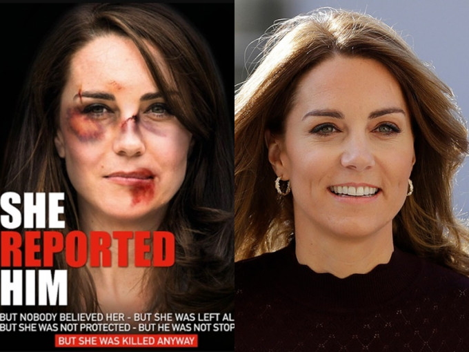 凯特(右)被改图制成家暴受害者(左)。网图/AP