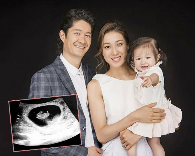 鍾嘉欣孖囡囡齊公佈再懷孕喜訊，並貼上一家三口幸福照，及超聲波照。
