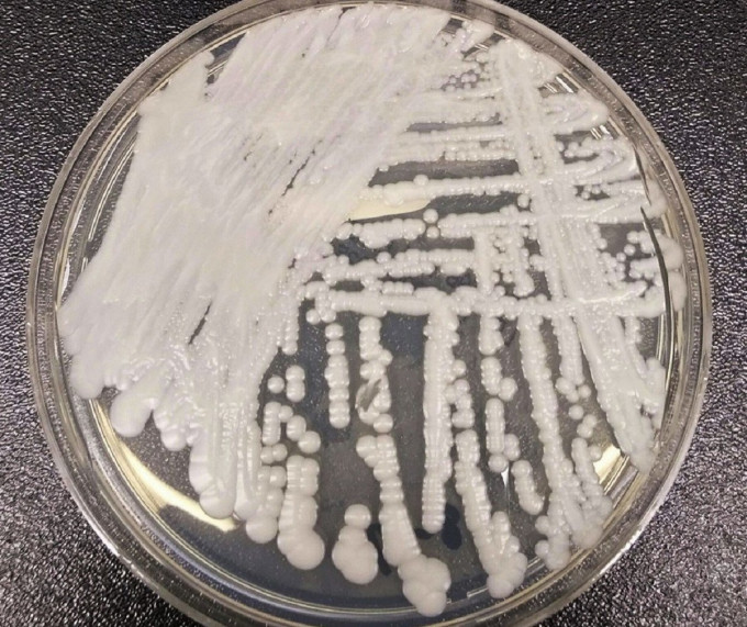 美國疾病控制與預防中心(CDC)一個實驗室在培養皿中培養出的「耳念珠菌」(Candida auris)。AP