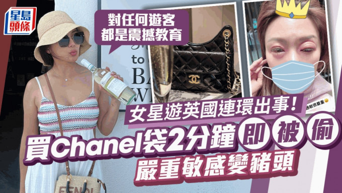 女星游英国连环出事！买Chanel袋2分钟即被偷 因一物严重敏感变猪头