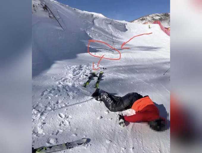 河北滑雪場遊客疑遭電纜絆倒摔亡。（網圖）