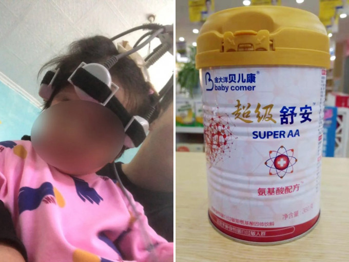 重庆3岁女童不会说话和走路，疑因喝「假奶粉」致智力受损。（微博图片）