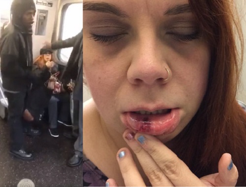 萨亚被对方挥拳打中她的嘴巴，嘴角裂开而流血。 网上图片