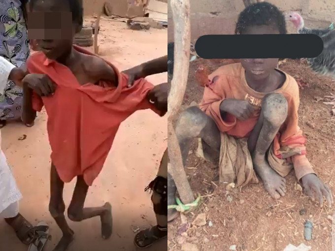 尼日利亚一名癫痫男童被绑畜舍两年后获救。 网图