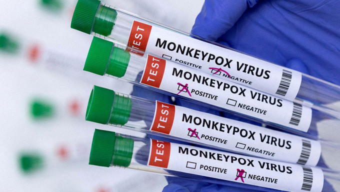 美国疾控及预防中心表示有证据显示猴痘出现本地传播。路透社图片