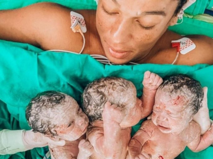 巴西母剖腹誕三胞胎後嚴重出血致併發症，搶救3天後終證實不治。
