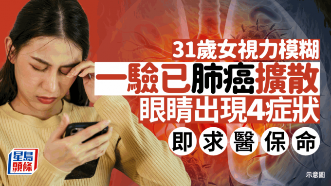 31岁女视力模糊 一验已肺癌扩散！医生吁眼睛出现4症状 即求医保命