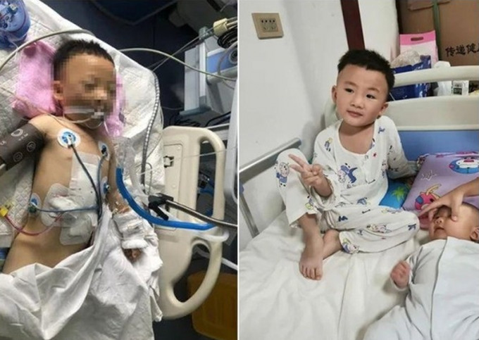 贵州铜仁市4岁奇迹男孩，28楼堕下重伤1个月后已能站立。(网图)