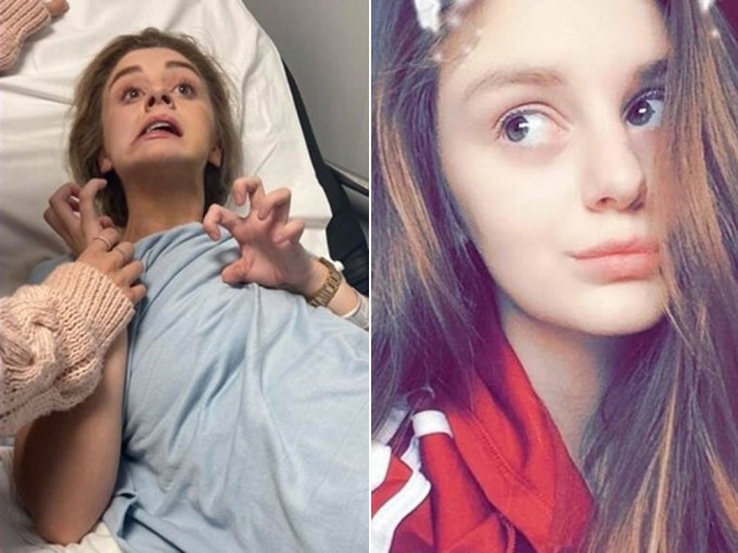 英女18歲夜店慶生飲品被落藥，臉部扭曲四肢抽搐如喪屍。FB圖