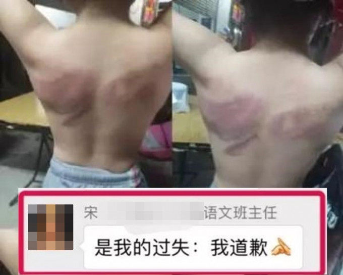 疑似體罰學生的女教師在家長群表示，「是我的過失，我道歉」。網圖