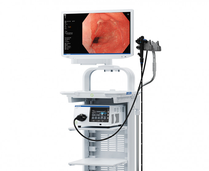 EVIS X1為奧林巴斯最先進內視鏡系統，具備人工智能輔助系統於檢查中協助醫生識別病變，本港已有醫療中心引入使用。