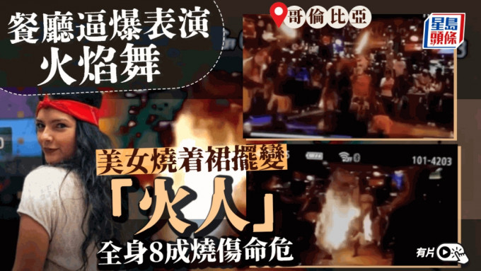 有片｜美女表演火焰舞變「火人」 全身八成燒傷命危  餐廳安全措施惹爭議