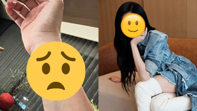 46岁女星视后做运动「爆静脉血管」！  伤势曝光网民纷纷劝做一事