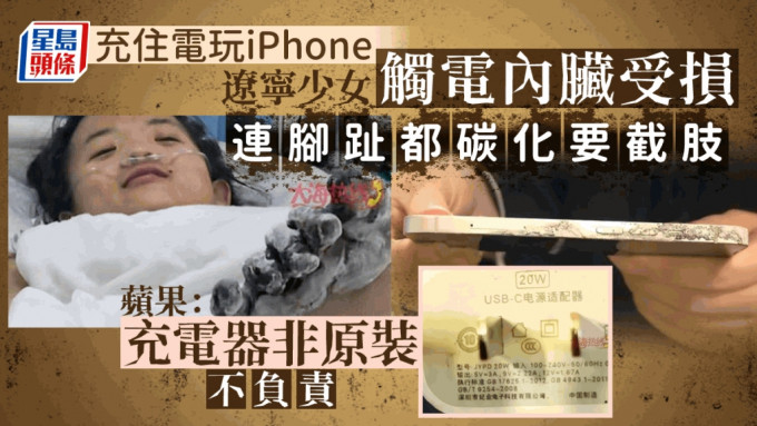 遼寧少女充電玩iPhone漏電要截肢 腳指燒成碳要截肢。 大海熱線