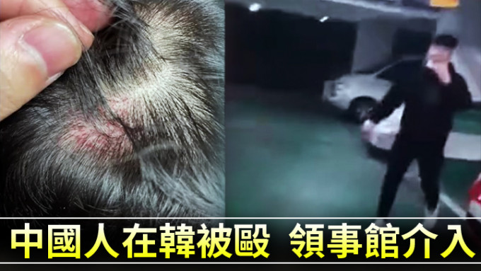 片中人（右）袭击中国留学生，其中一人头部受伤（左）。互联网图片