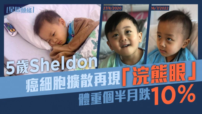 Sheldon癌细胞扩散再现「浣熊眼」。FB图片