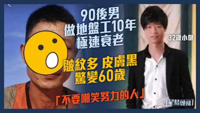 90後男做地盤10年急速老化 皺紋多皮膚黑驚變60歲：不要嘲笑努力的人