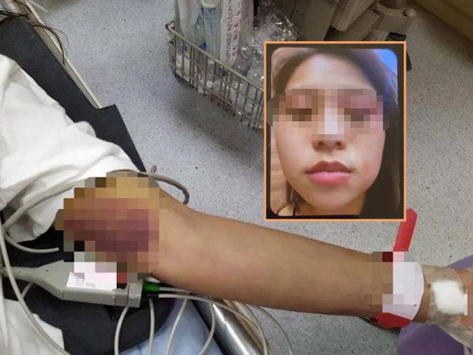 胡女生前曾向家人发送伤痕照。互联网图片