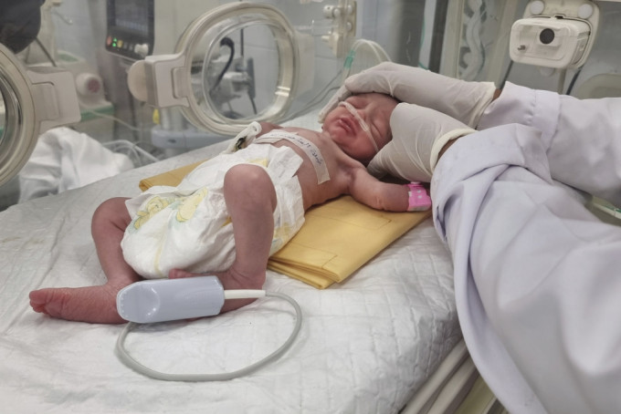 巴勒斯坦医护人员对一名已死孕妇进行紧急剖腹，成功诞下这名女婴。美联社