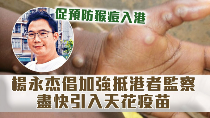 杨永杰促请政府超前部署，预防猴痘入侵香港。资料图片