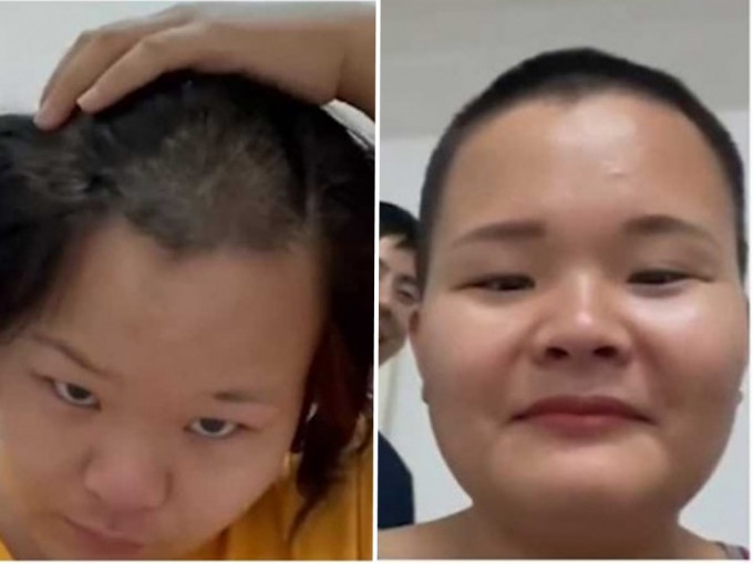 (左圖)媽媽睡醒後驚見頭頂出現「鬼剃頭」，(右)其後她索性剃掉全部頭髮。網上圖片