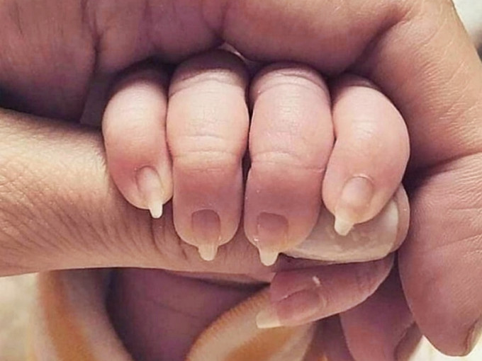 外国有人将一名婴儿的指甲修成猫爪状，惹来一众网民批评。网图
