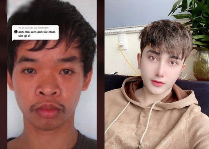 越南男子杜文奎整容前被嘲樣貌醜找不到工作(左)，結果他整容九次變成另一個樣子(右)。網圖