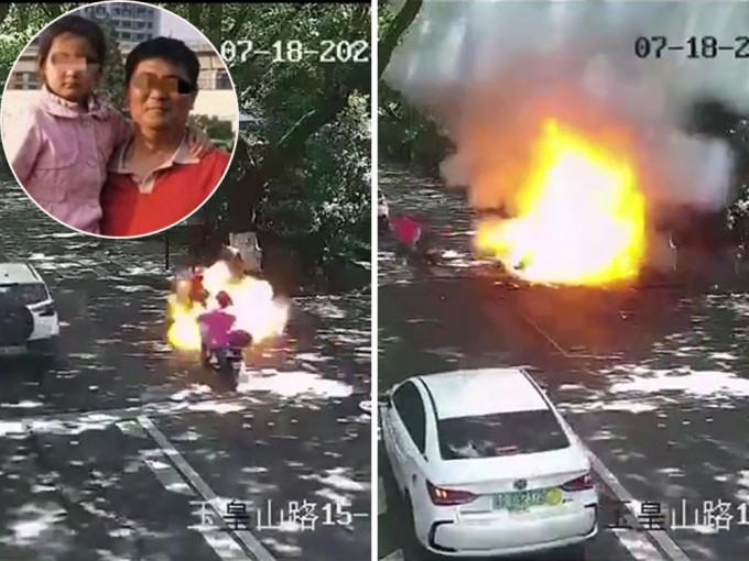 杭州父女騎電動車行駛中自爆，7歲女兒全身九成被燒傷。