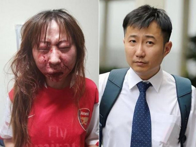 新加坡医生张顺杰（右），被林姓女友（左）指控酒后求欢遭拒后，将对方锁在房内暴打，张被判罪名成立。（网图）