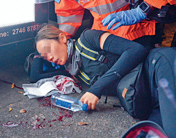 尖沙嘴一名女示威者右眼受伤，怀疑被布袋弹击中。资料图片