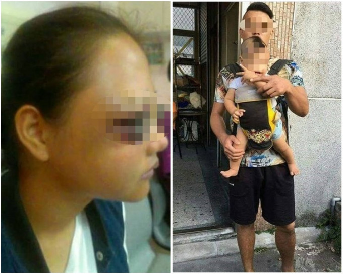 台中22歲女子(左)遭同居男友(右)施暴，臉頰骨碎裂、右眼瘀青腫脹。網圖