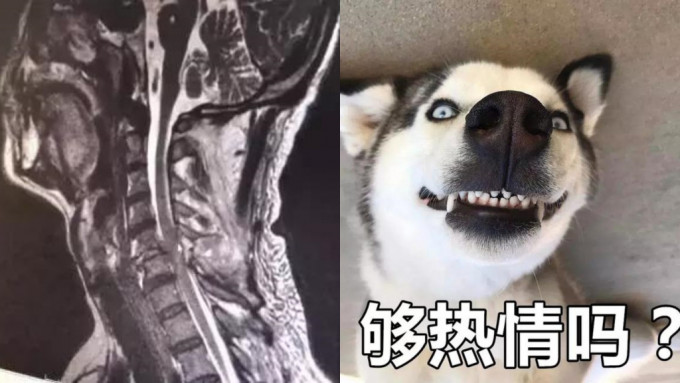 雪橇犬從3樓一躍而下砸傷主人。網圖