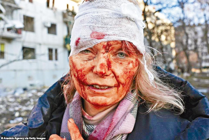 烏克蘭倖存女教師滿臉鮮血，成為象徵這場戰爭的臉孔。