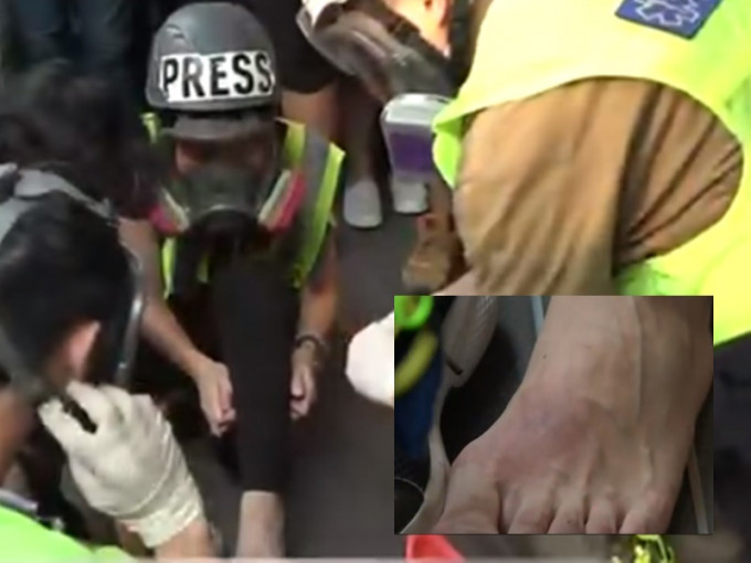 疑有记者脚部受伤。港台图片
