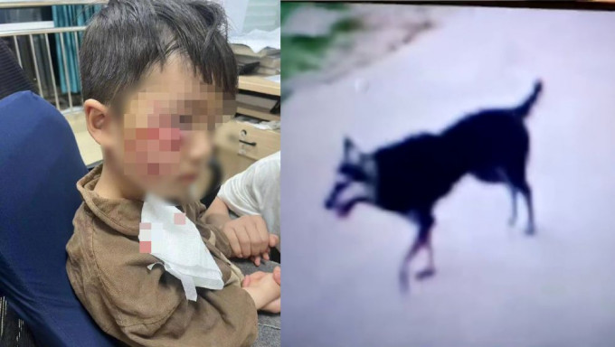 河南3歲童被狗咬傷，苦撐18日後離世，其母指至今未找到狗主。