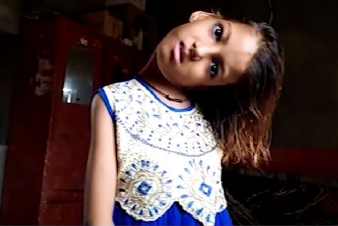 巴基斯坦女童90度扭曲 。网上图片