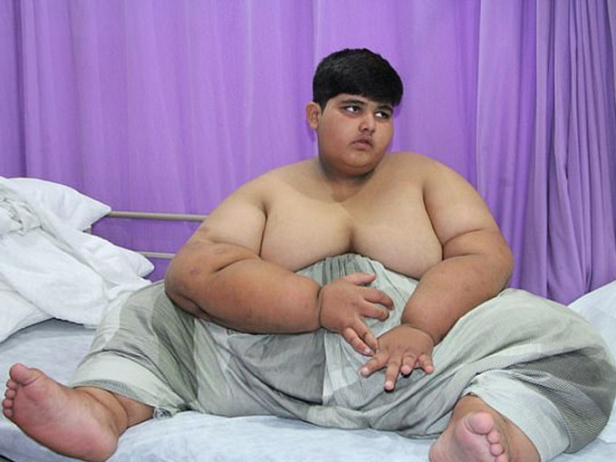 巴基斯坦的穆罕默德·阿布拉爾被稱為「世界最胖小孩」，10歲的他體重達197公斤。(網圖)