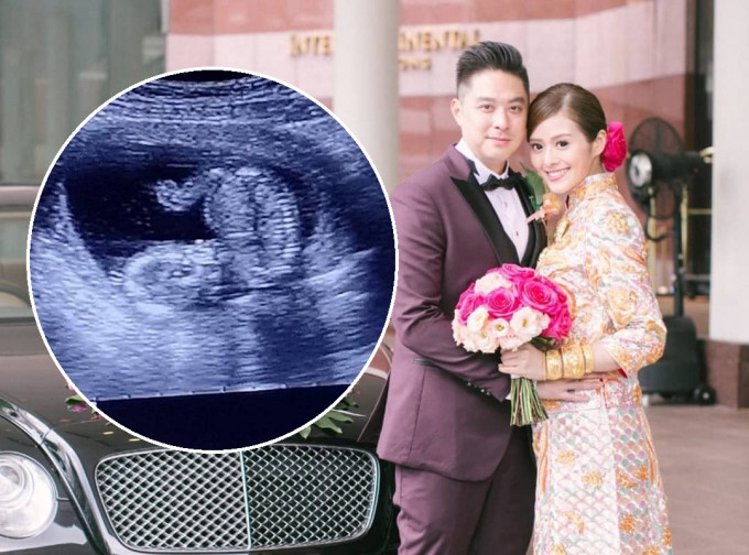 許芷熒上月與商人Alexander Fung結婚，今日再公布佗Ｂ喜訊。　