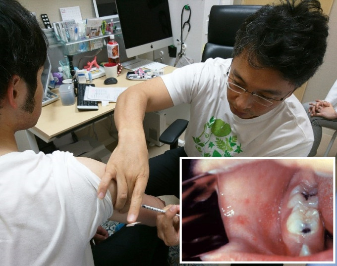 患者发烧3至4天后，口腔内出现斑点（柯式斑点）。网图