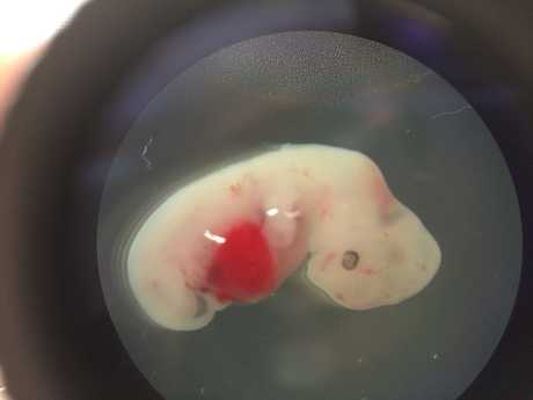 科學家首次培育出人豬嵌合體胚胎。 AP